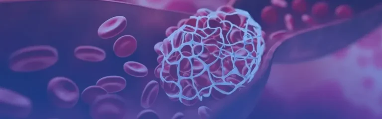 Deep Venous Thrombosis